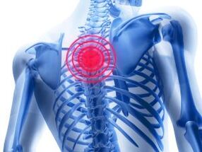 osteochondrosis នៃតំបន់ thoracic